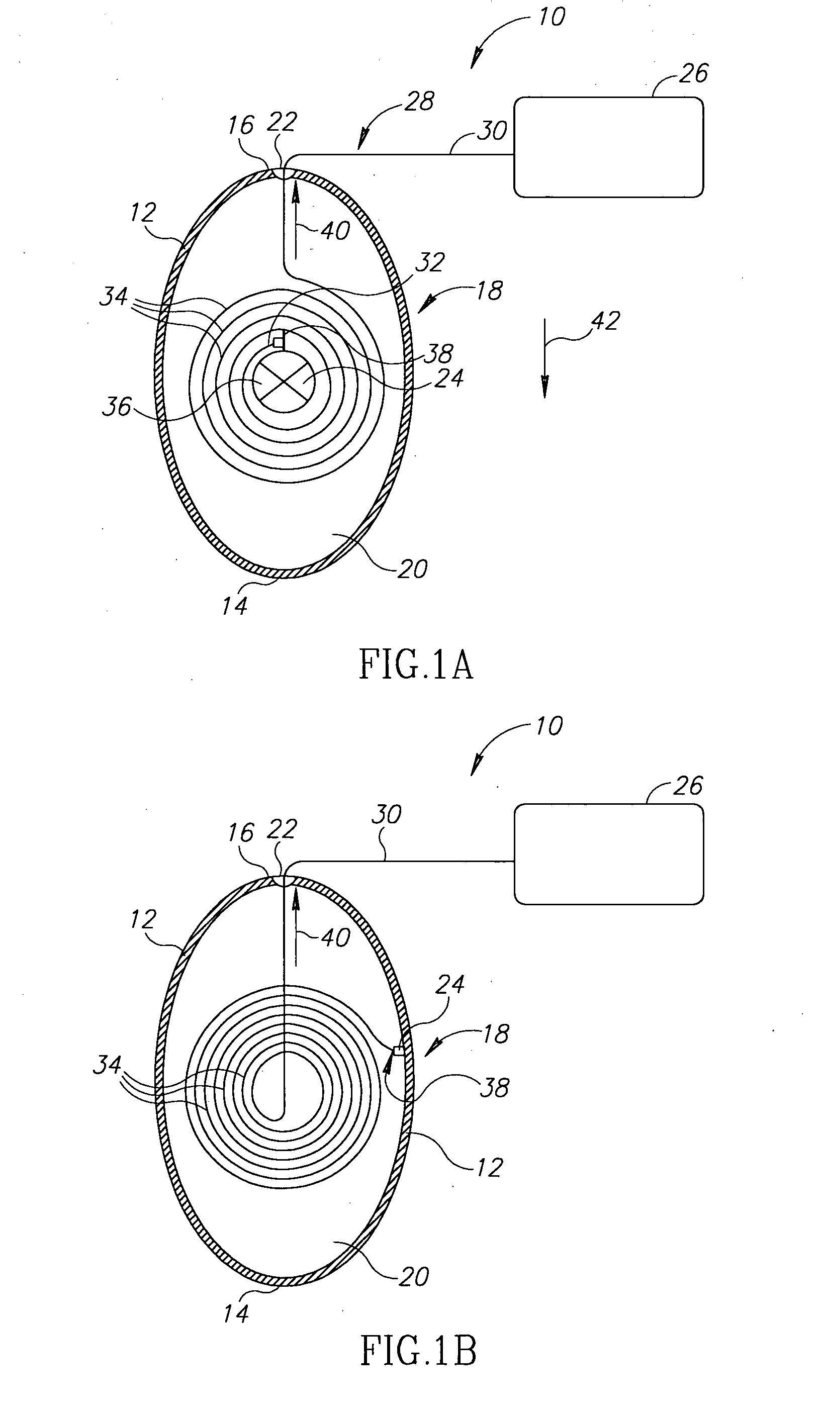 System and method for guiding of gastrointestinal device through the gastrointestinal tract
