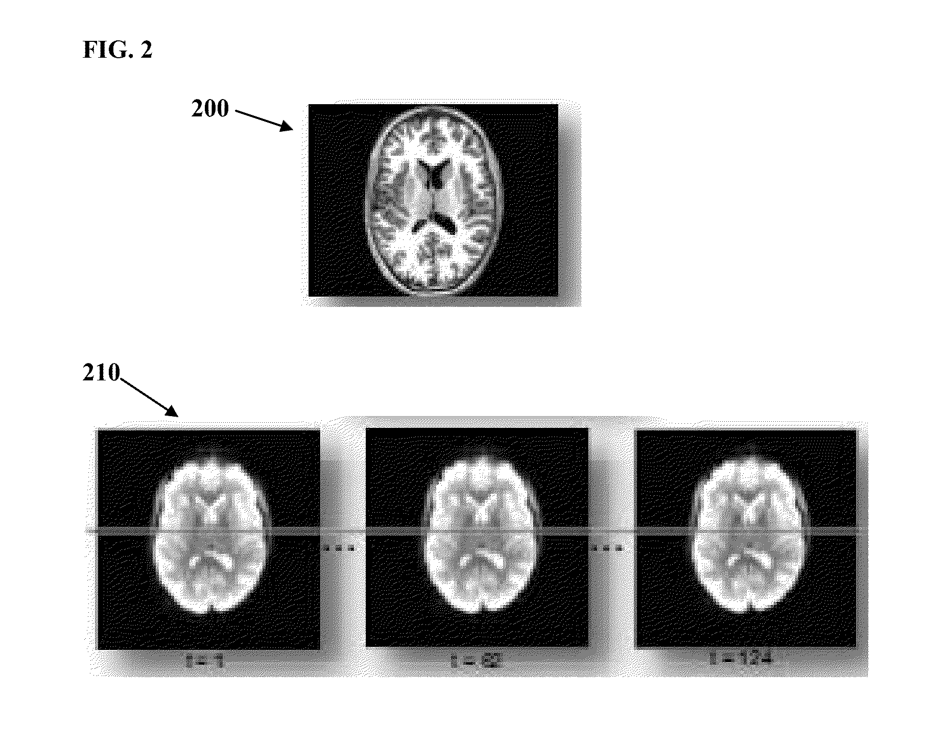 Method and System for Diagnosis of Attention Deficit Hyperactivity Disorder from Magnetic Resonance Images