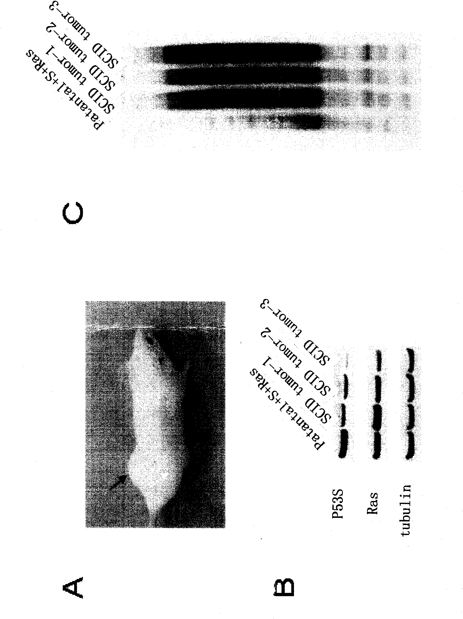 Peculiar p53 mutated protein-p53N236S of ALT tumor caused by progeria syndrome and application thereof