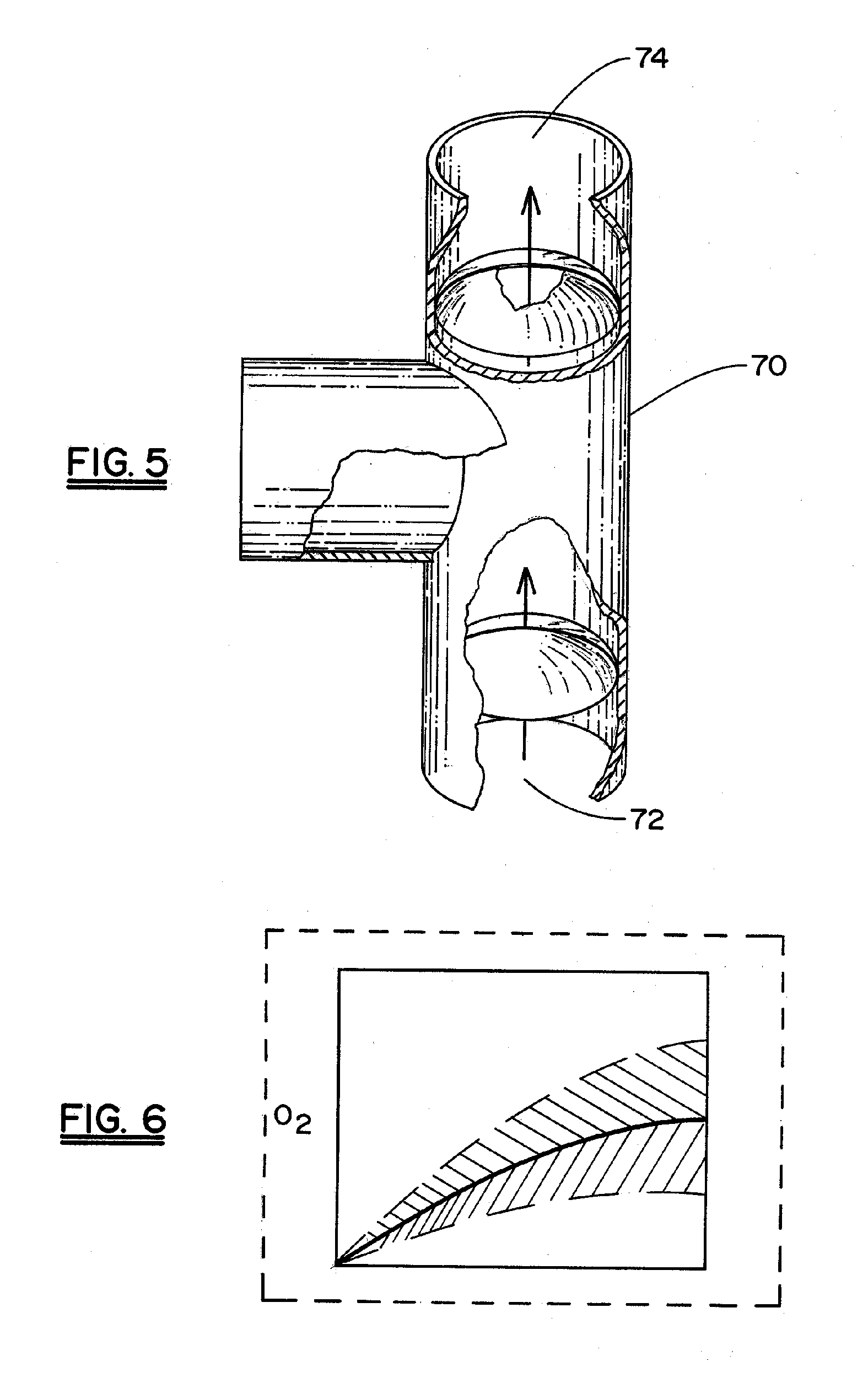 Non-Invasive Device and Method For the Diagnosis of Pulmonary Vascular Occlusions
