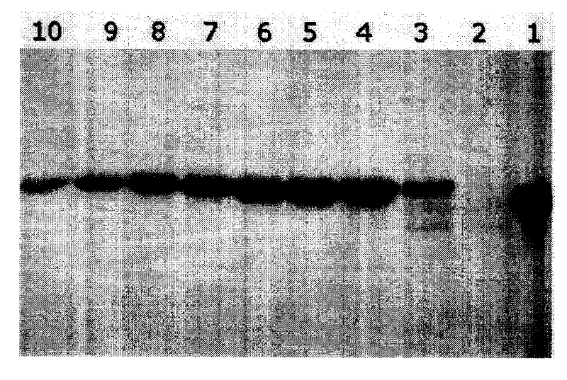 Syphilis spirochete membrane antigen with shortened expression and uses thereof