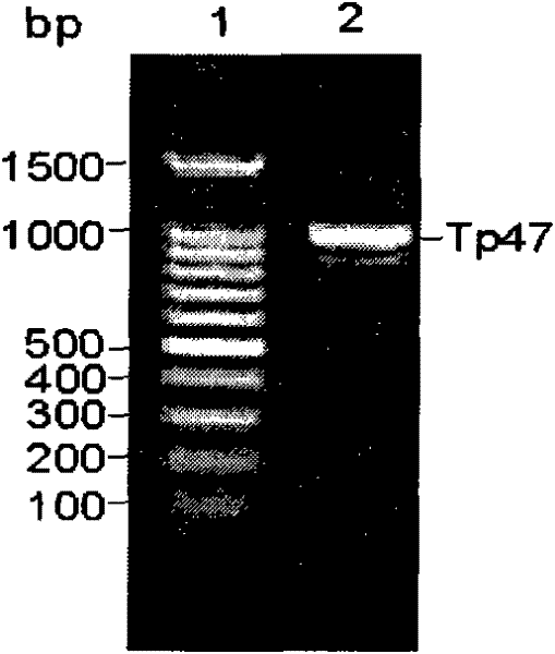 Syphilis spirochete membrane antigen with shortened expression and uses thereof