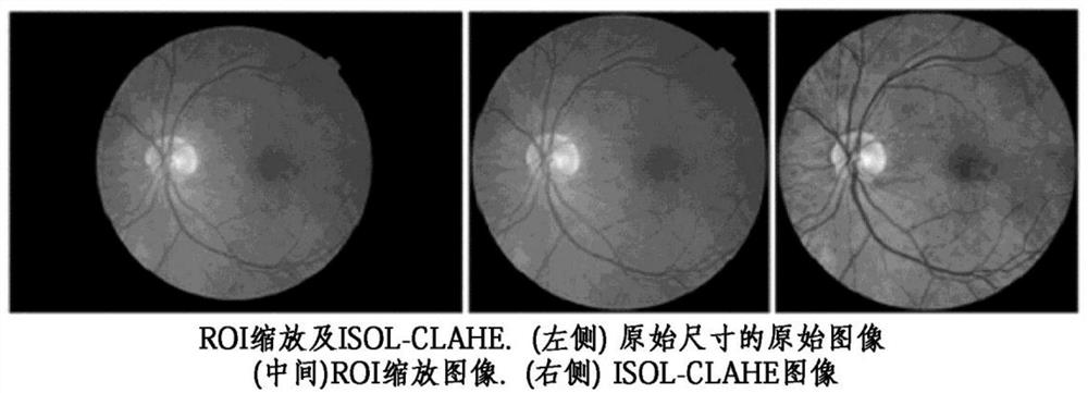 Eye fundus image classification device and method based on deep learning for diagnosing eye diseases
