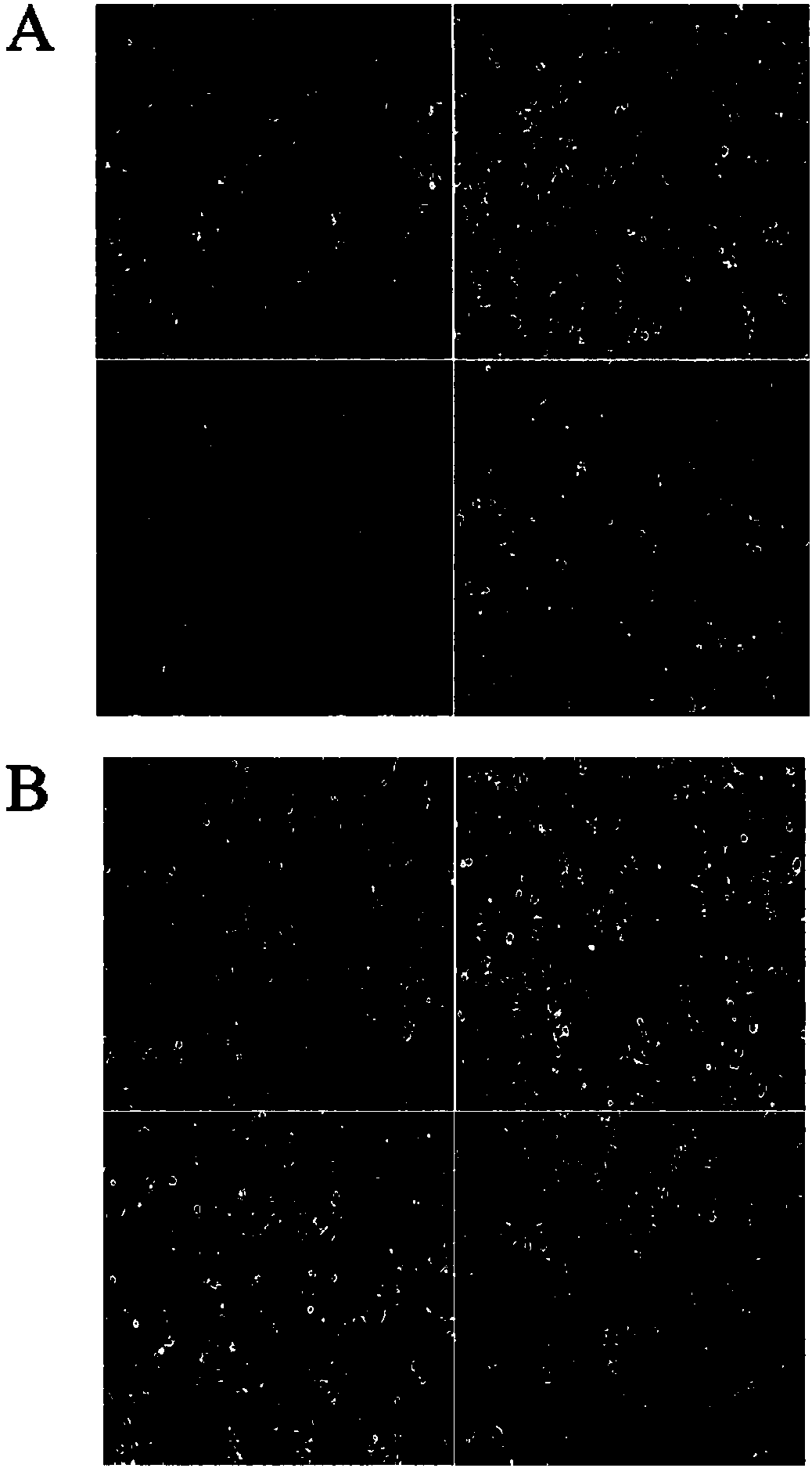 Dragon tree total flavone extraction method and application of total flavone