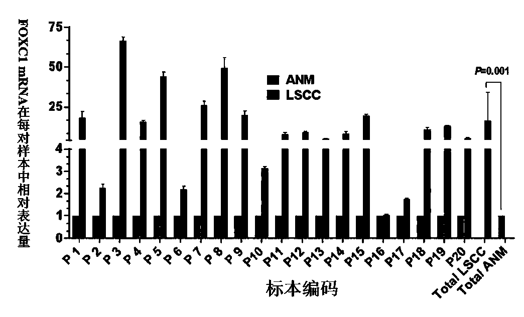siRNA for FOXC1 gene expression inhibition, and application thereof