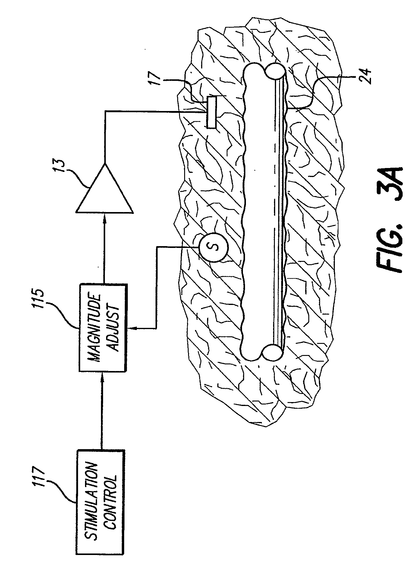 Neural stimulation system providing auto adjustment of stimulus output as a function of sensed impedance