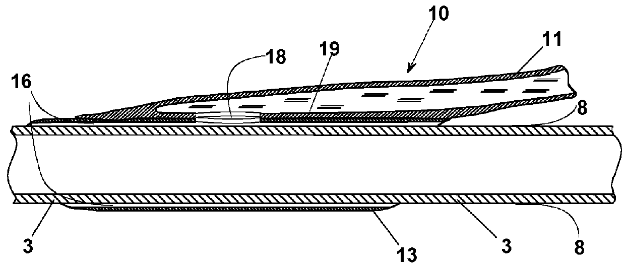 Occlusion device for vascular surgery