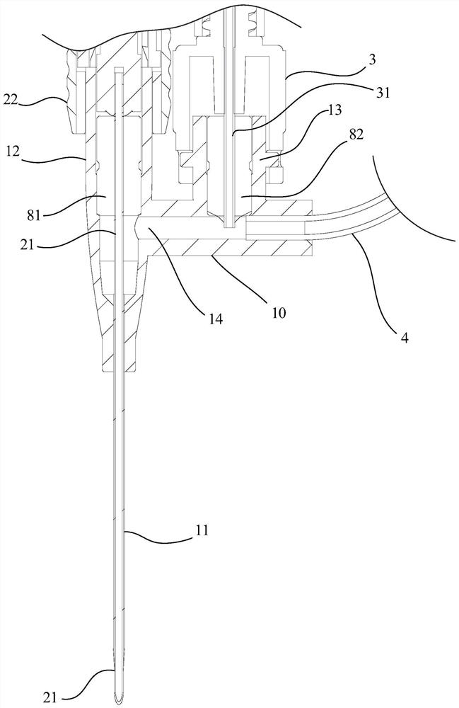 Blood collection indwelling needle, blood collection indwelling assembly and operation method