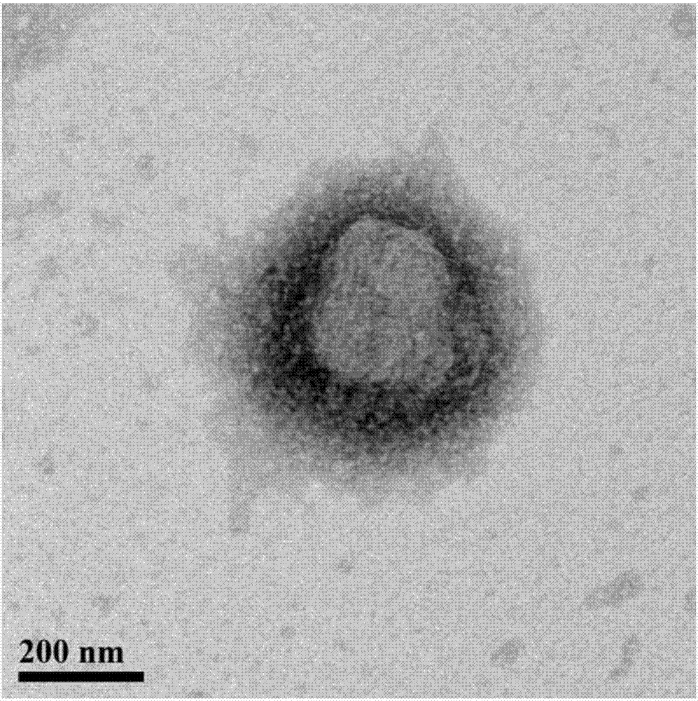 Synthesis for biodegradable amphiphilic block copolymerization antibacterial peptoids, preparation method of antibacterial peptoid vesicles and applications of antibacterial peptoid vesicles
