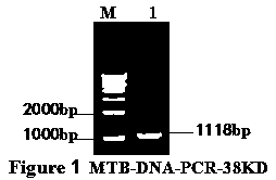 Mycobacterium tuberculosis 38KD protein DNA extraction and recombinant vector construction expressing method