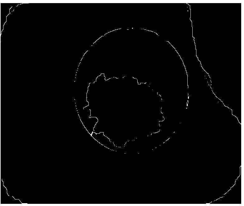 Oil well pipe sleeve damage image edge detection method based on grey correlation analysis and Zernike moment