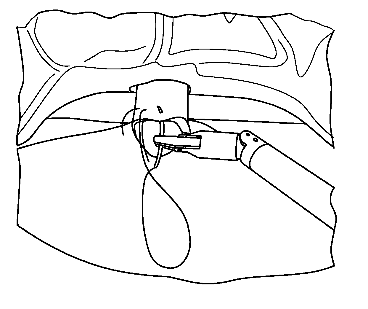 Urethrovesical Anastomosis Suturing Method Using Articulating Laparoscopic Device