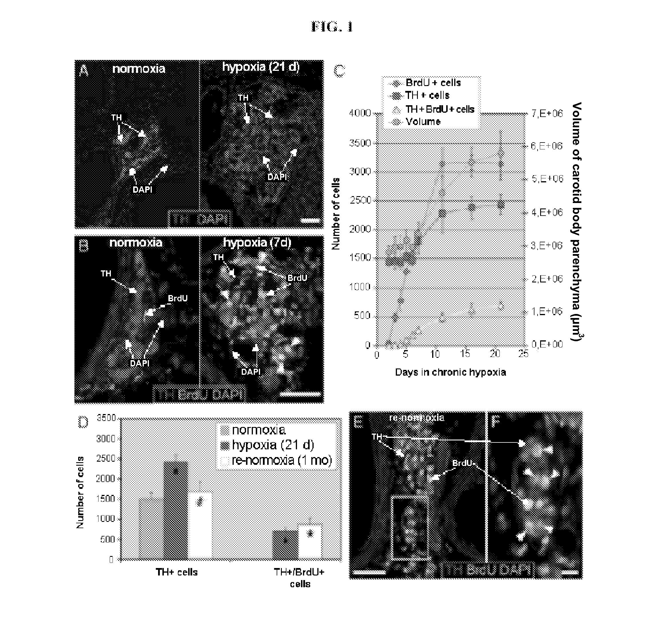 Stem cells derived from the carotid body and uses thereof