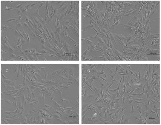 Method for establishing tree shrew immortalized skin fibroblasts