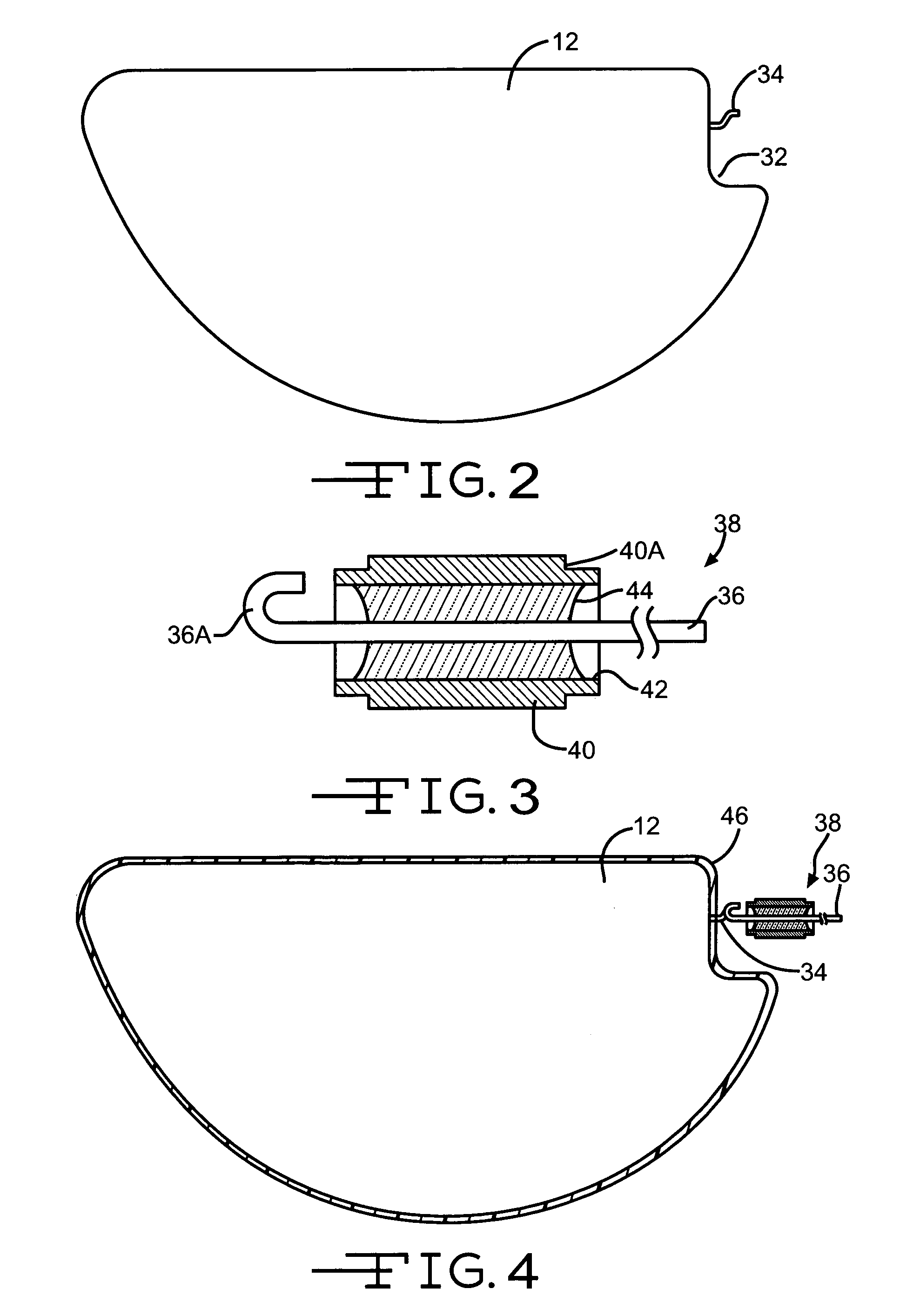 Molded polymeric cradle for containing an anode in an electrolytic capacitor from high shock and vibration conditions