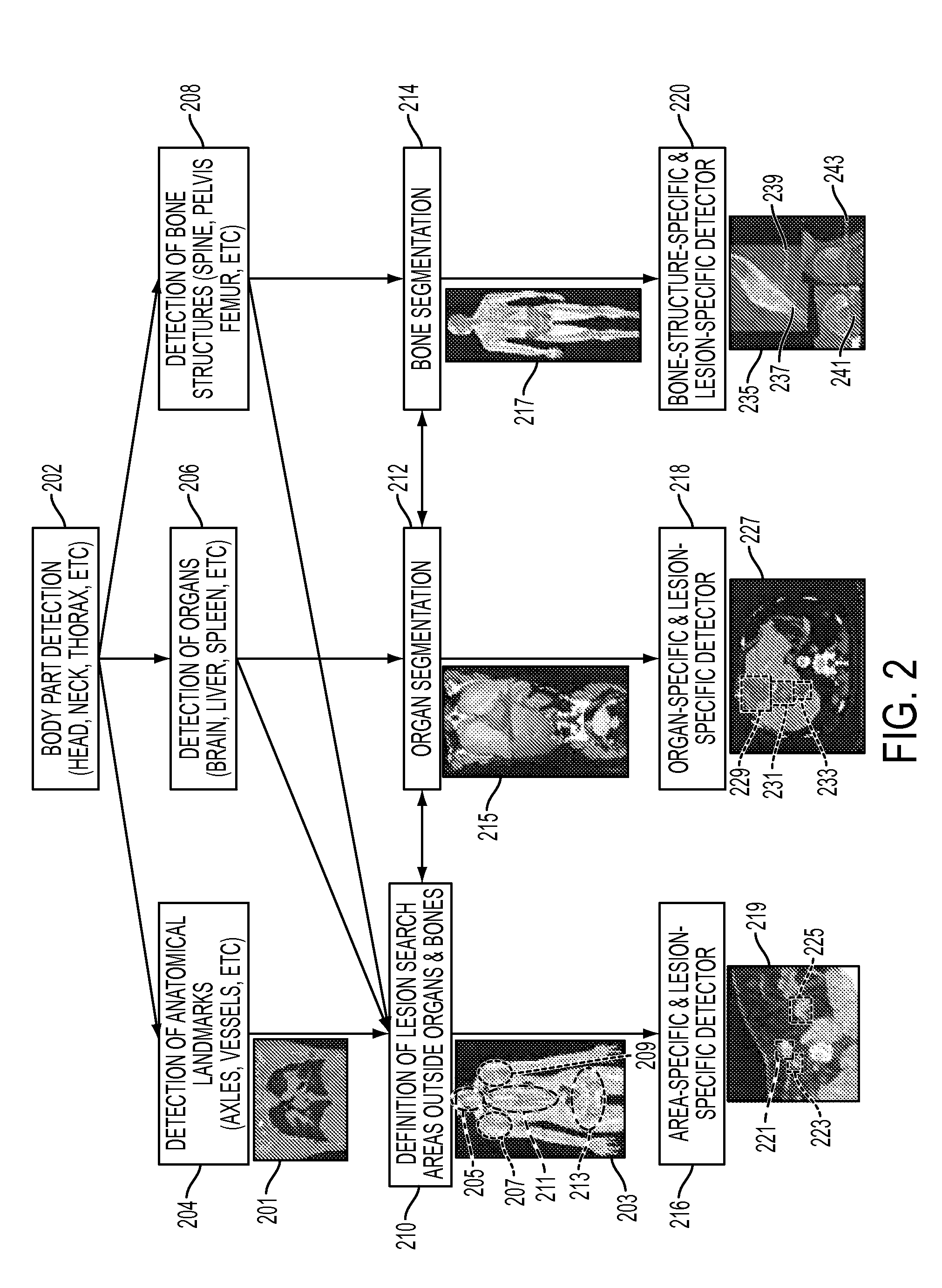 Method and System for Database-Guided Lesion Detection and Assessment