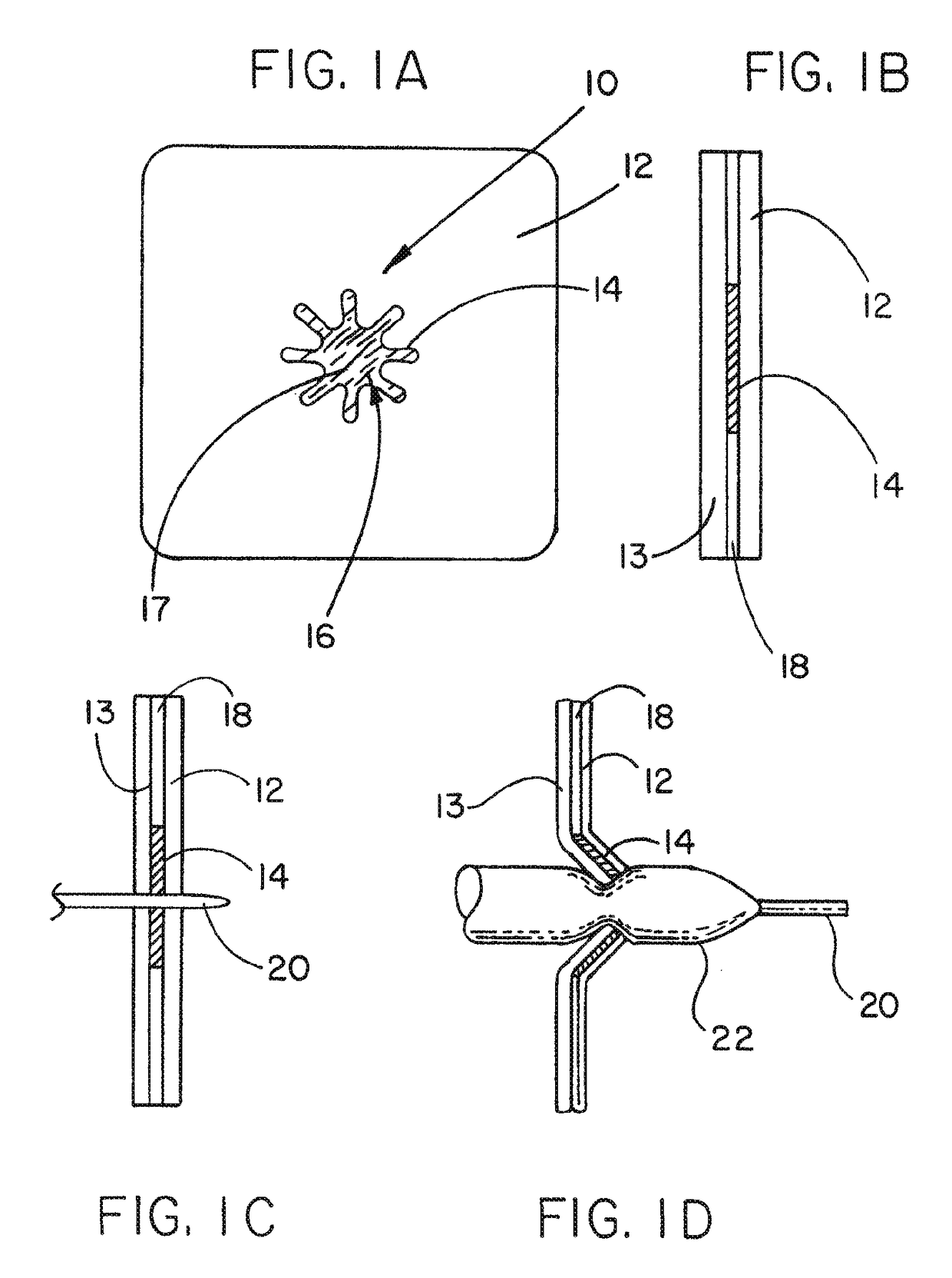 Medical device ameneable to fenestration