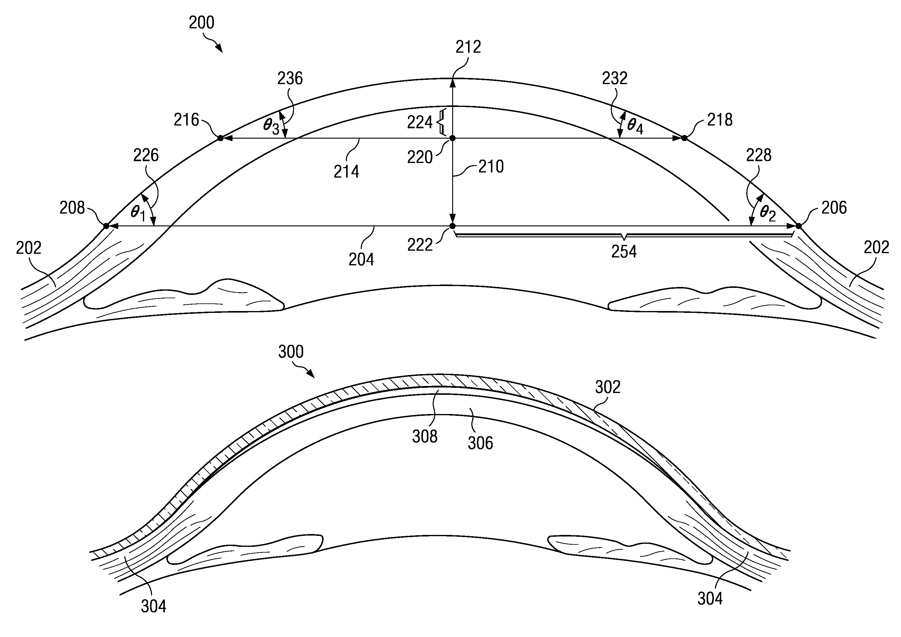 Method of fitting rigid gas-permeable contact lenses from high resolution imaging