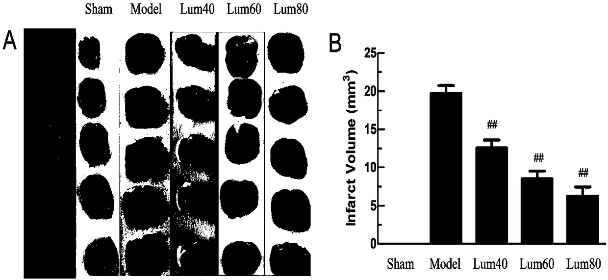 Nerve injury resisting method of ischemic brain injury animal model