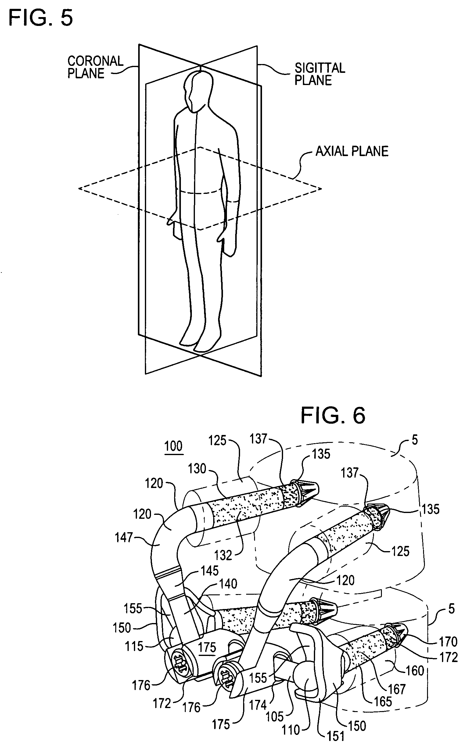 Crossbar spinal prosthesis having a modular design and related implantation methods