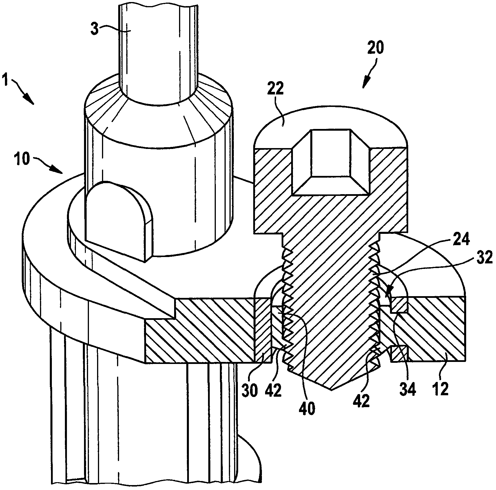 Structure of a build-in screw in a bushing and corresponding sensor housing