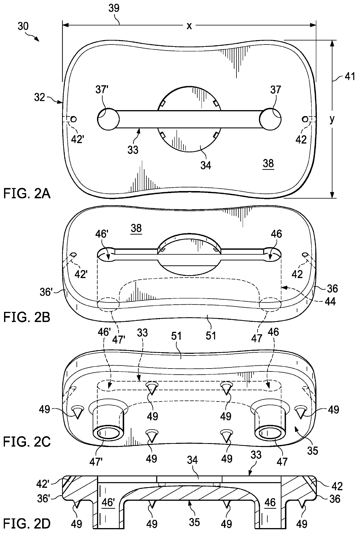 Glenoid bone graft retention plate