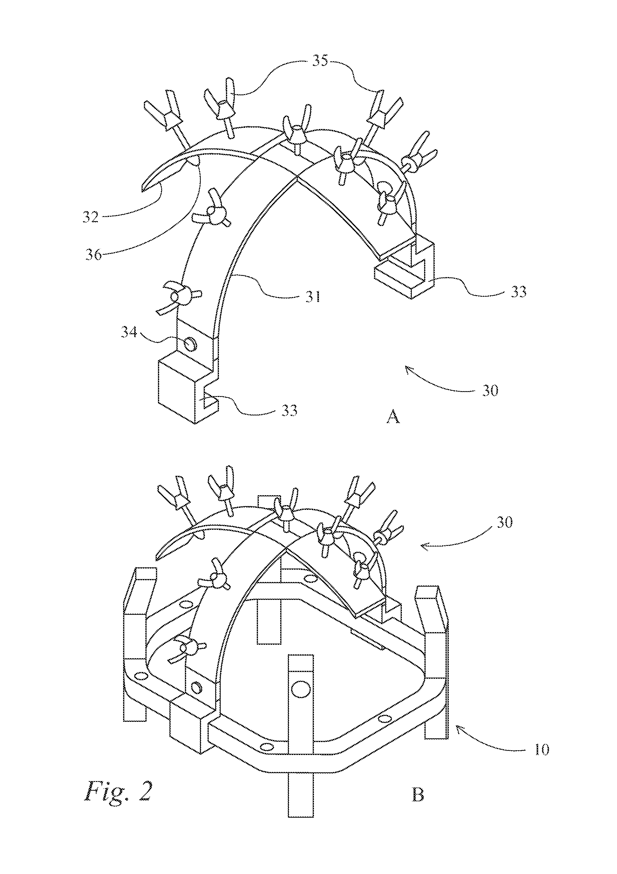 Devices and methods for positioning a stereotactic frame
