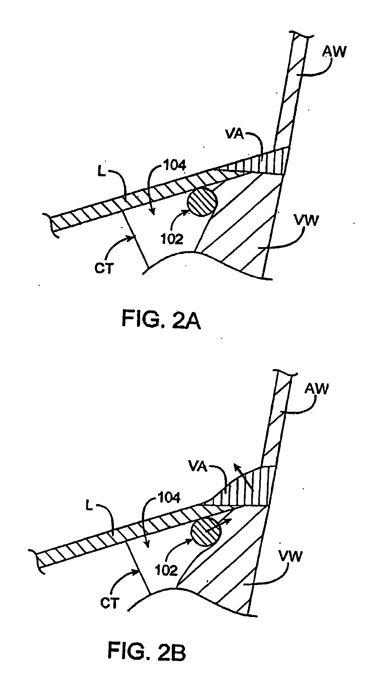 Methods and devices for termination