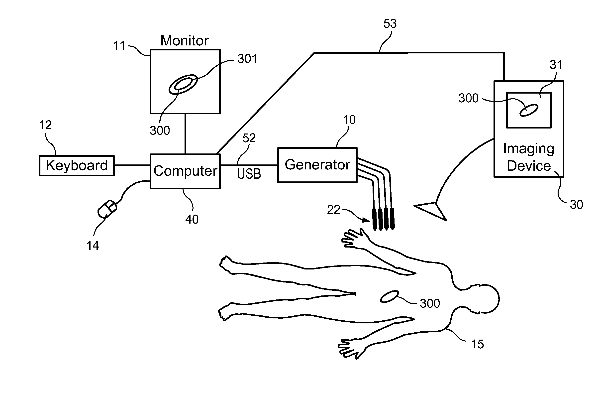 System and Method for Ablating a Tissue Site by Electroporation with Real-Time monitoring of Treatment Progress