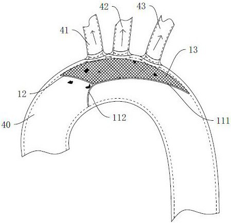 Anti-embolism protection device and medical device