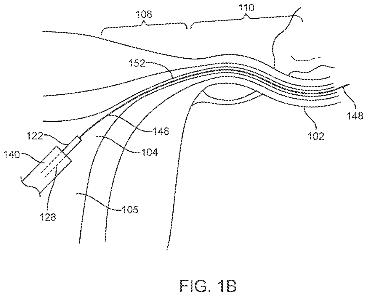 Systems and methods for permanent female contraception