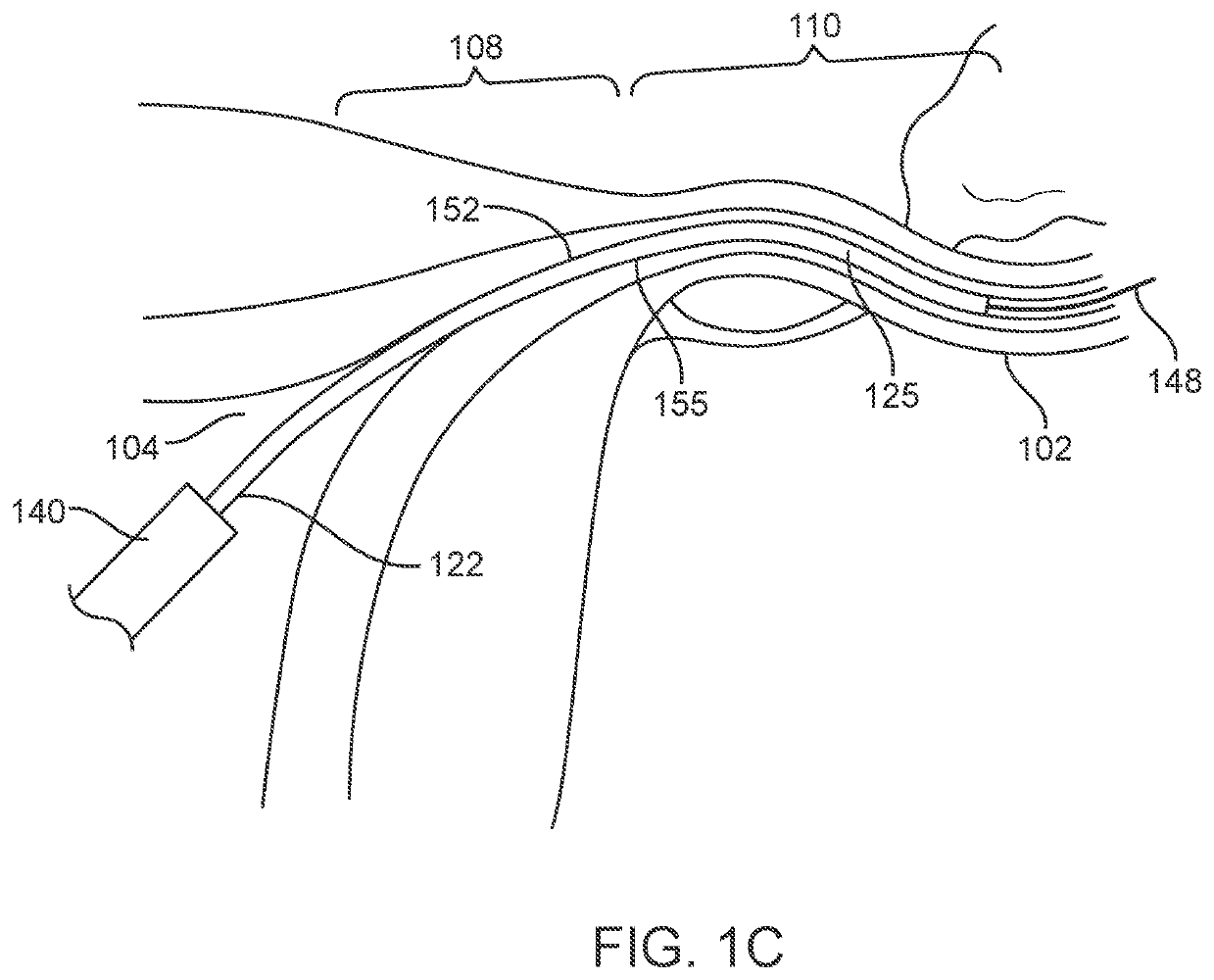 Systems and methods for permanent female contraception