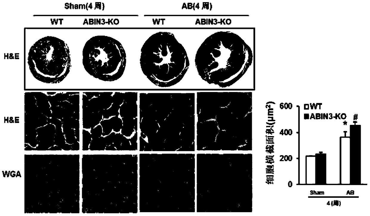 Function and application of A20-binding nuclear factor inhibitory protein 3 (abin3) in the treatment of cardiac hypertrophy