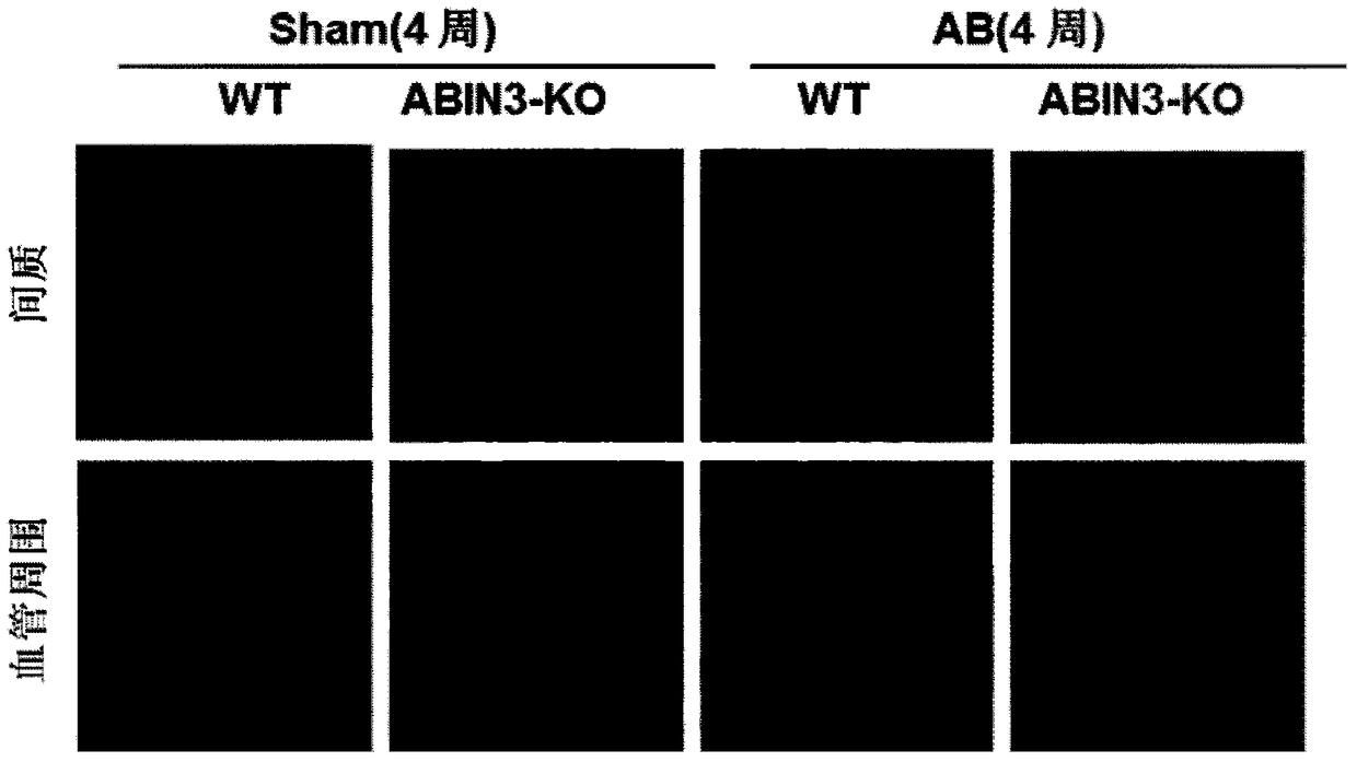 Function and application of A20-binding nuclear factor inhibitory protein 3 (abin3) in the treatment of cardiac hypertrophy
