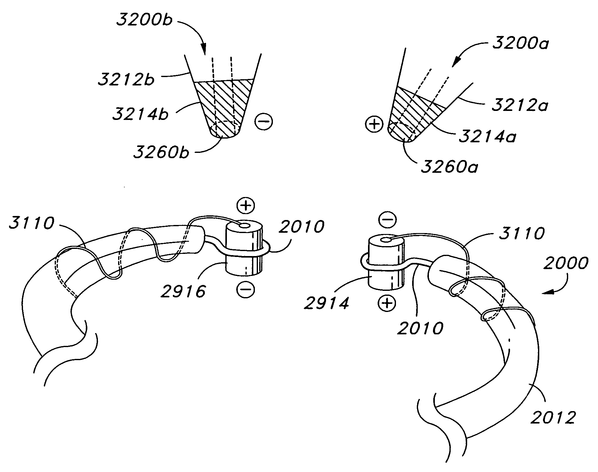 Magnetic engagement of catheter to implantable device