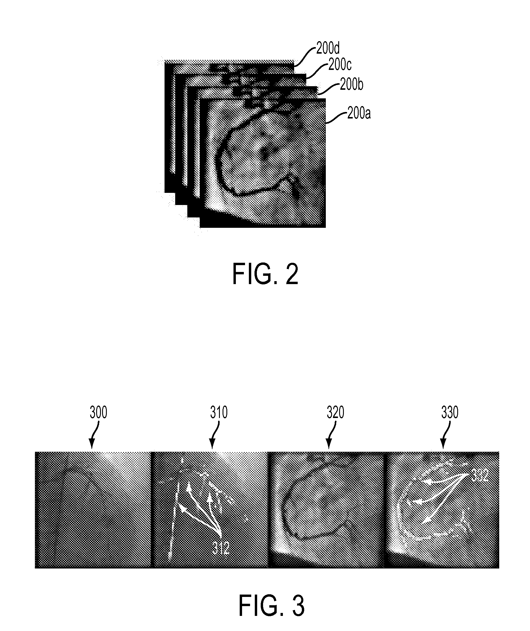 Method and System for Contrast Inflow Detection in 2D Fluoroscopic Images