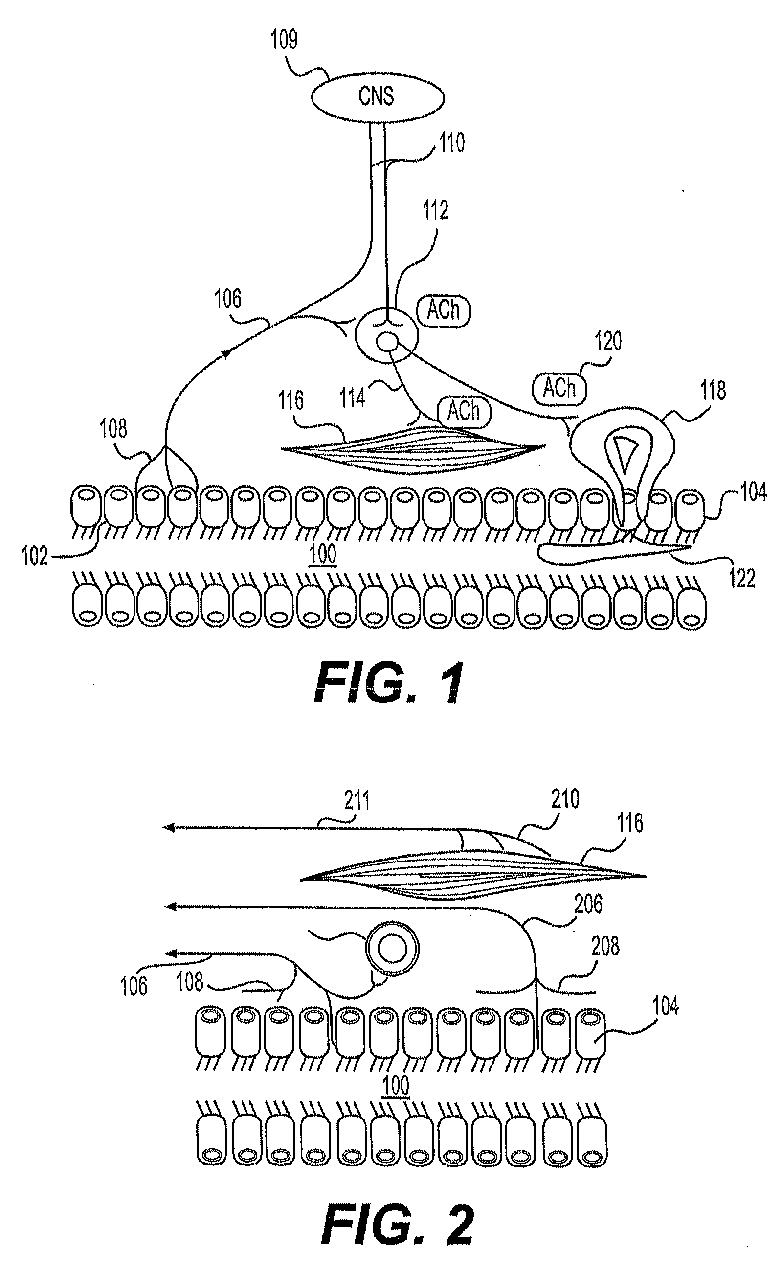 Airway diagnosis and treatment devices and related methods of use
