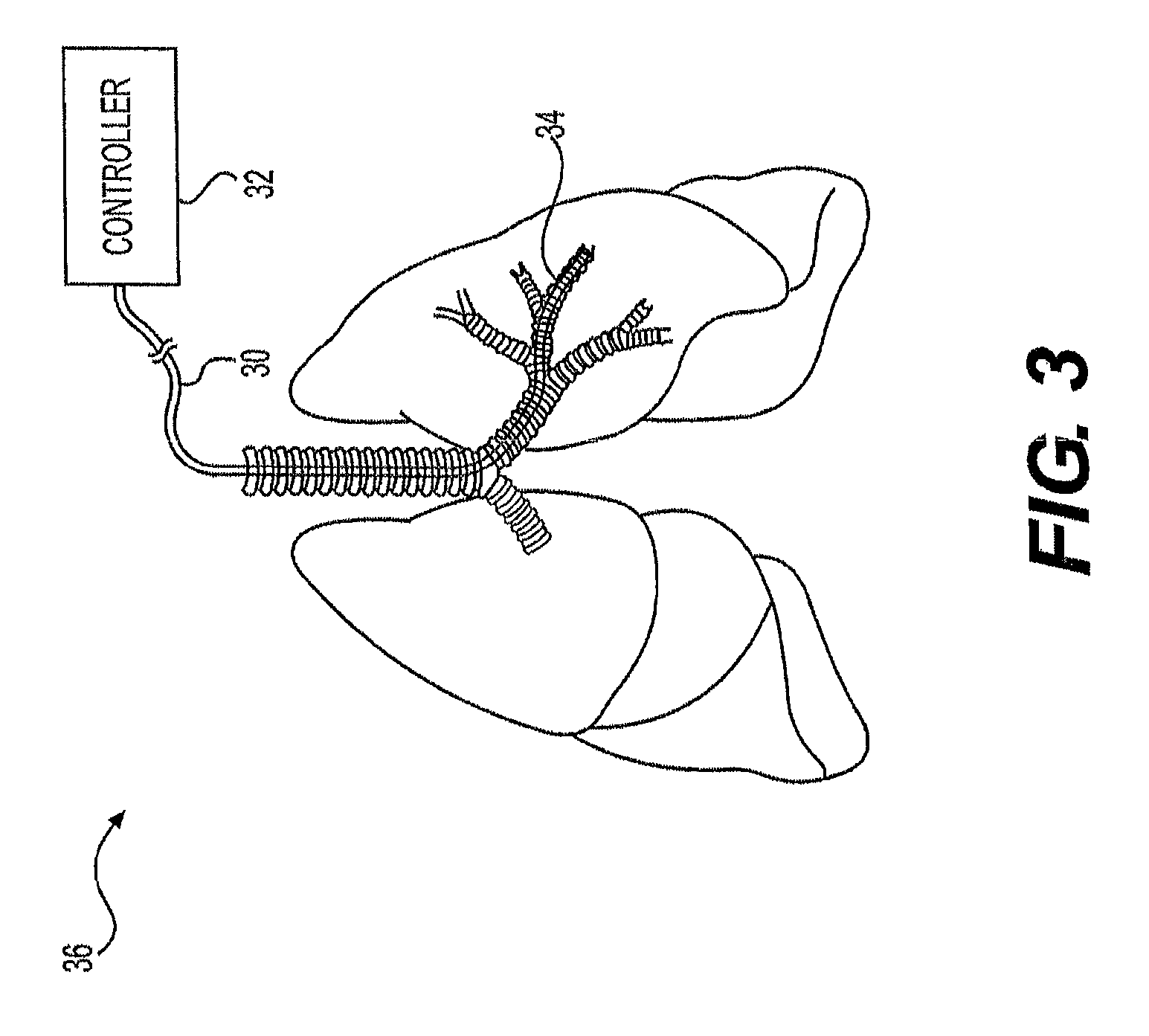 Airway diagnosis and treatment devices and related methods of use