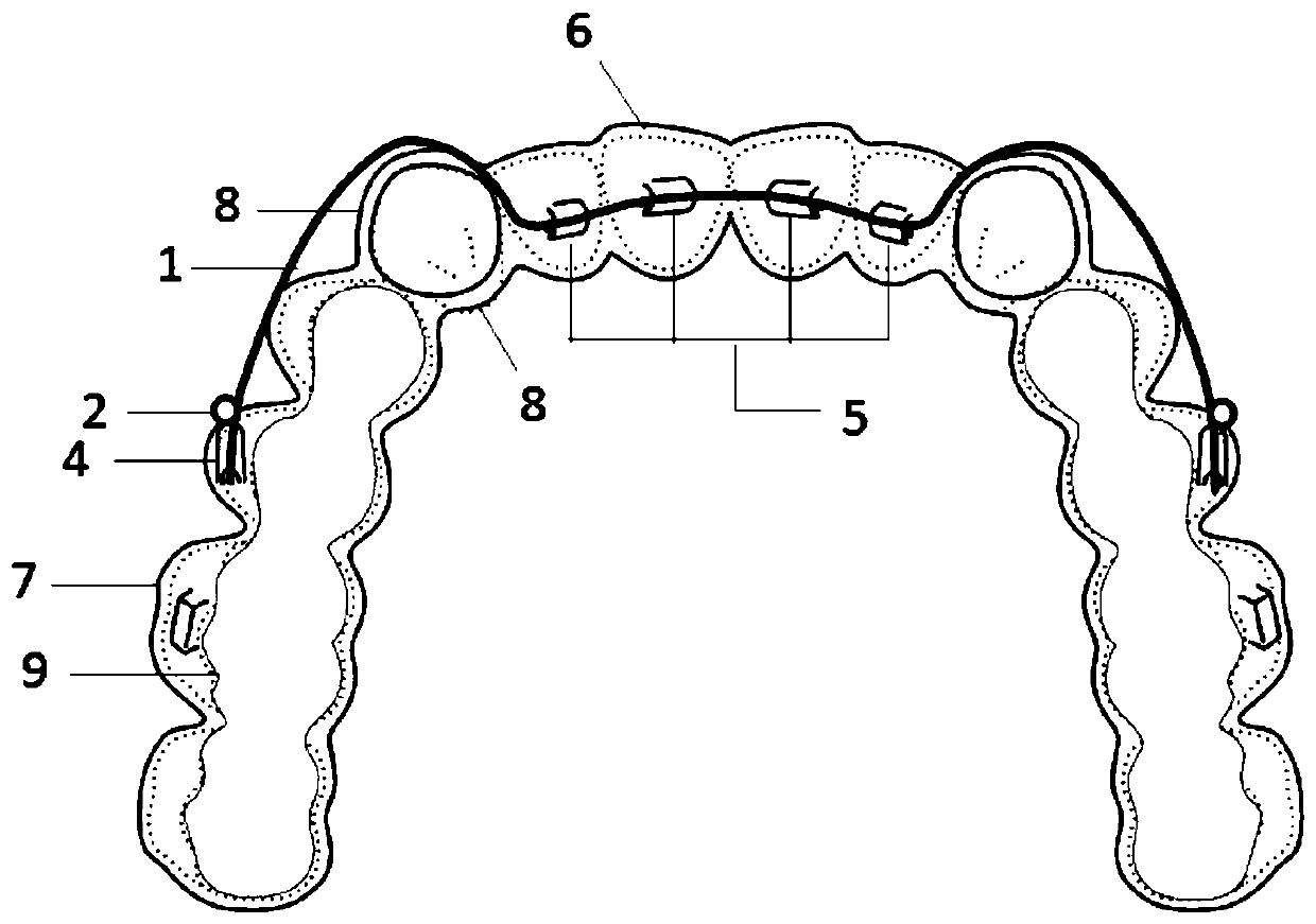 Cat-shaped auxiliary arch invisible correcting and curing appliance