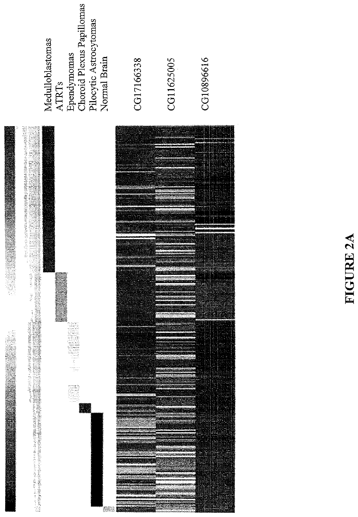 Method of diagnosing cancer