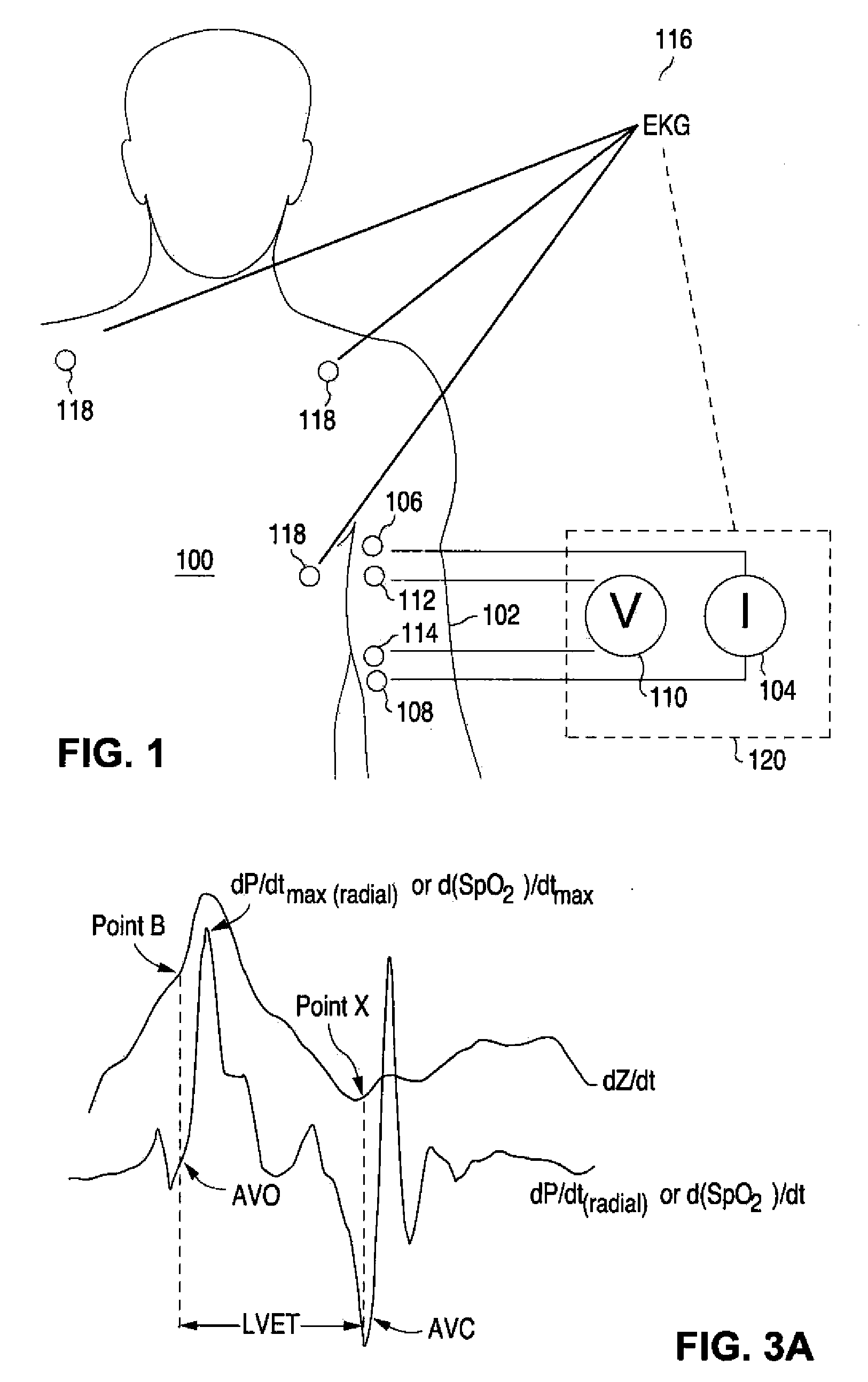 Apparatus And Method For Determination Of Stroke Volume Using The Brachial Artery