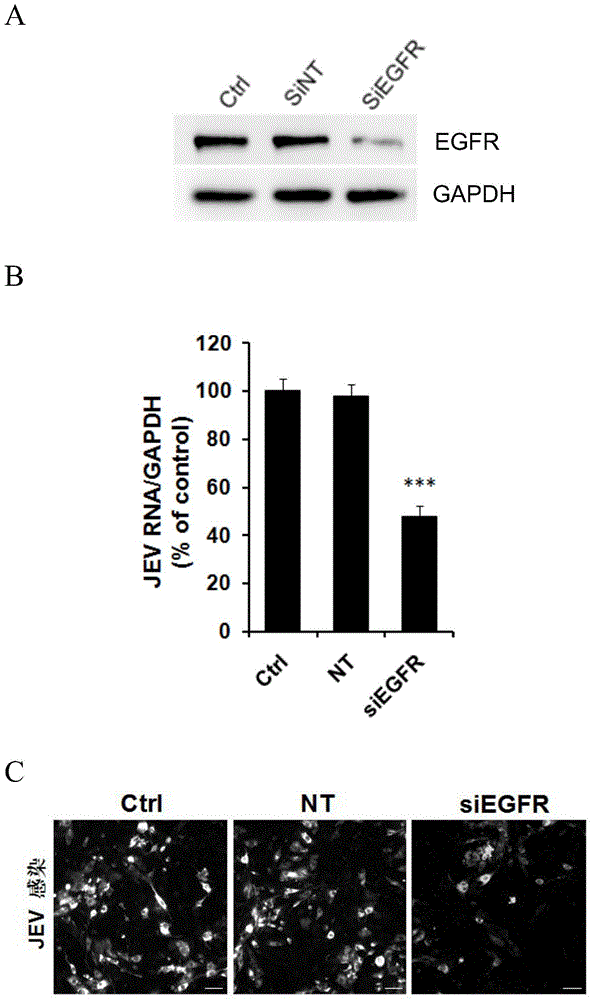 Application of EGFR (Epidermal Growth Factor Receptor) inhibitor in preparation of medicine for treating JE (Japanese Encephalitis)