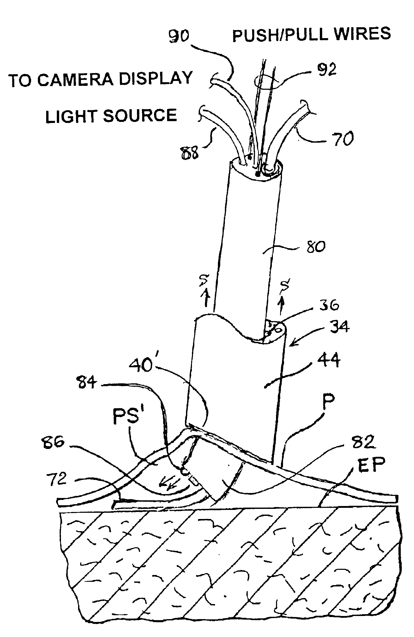 Anatomical space access tools and methods