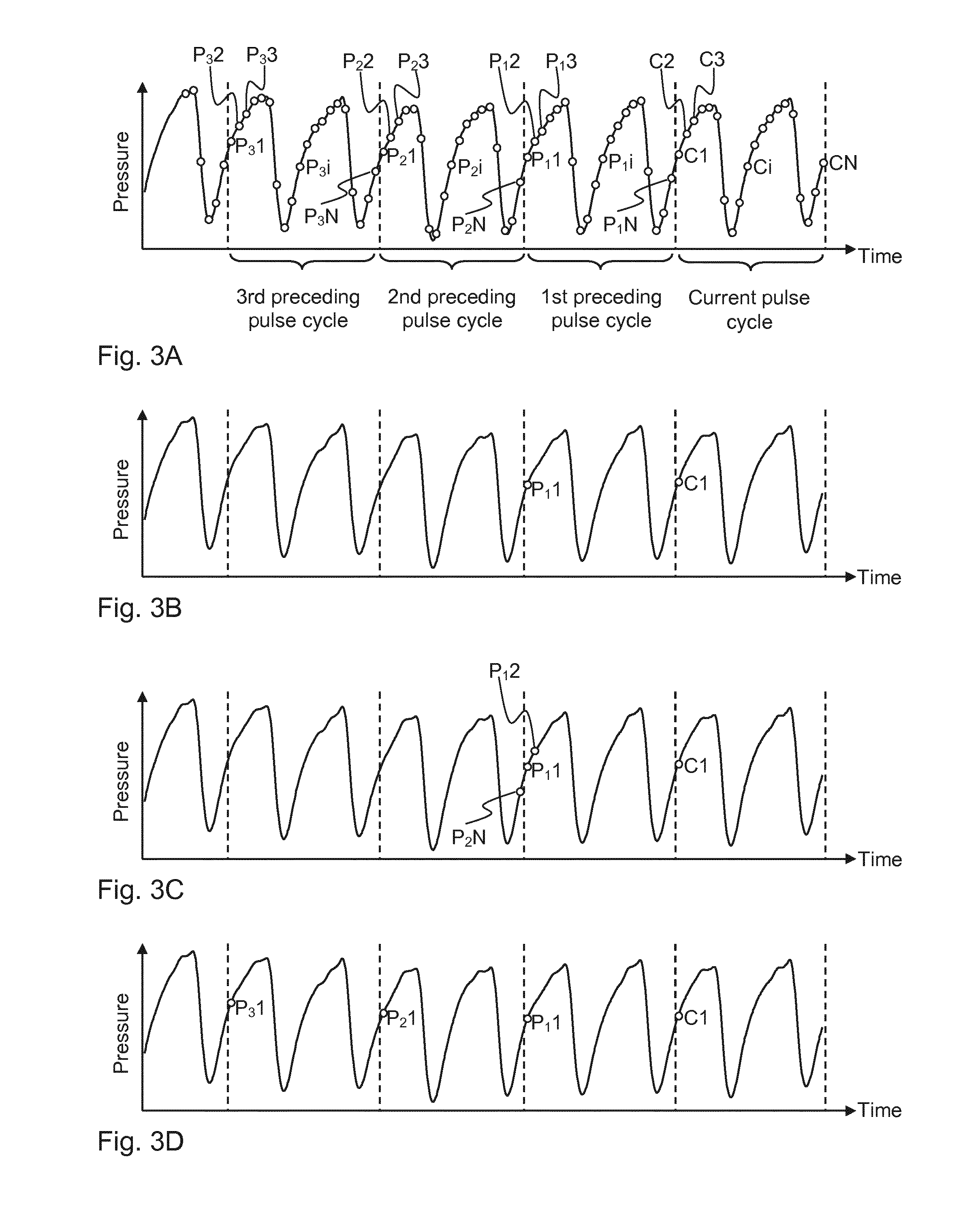 Filtering of a time-dependent pressure signal