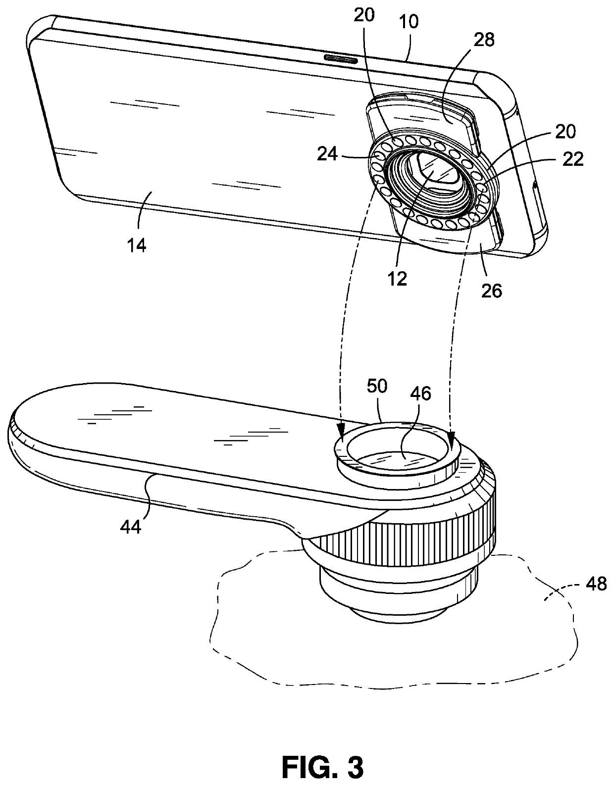 Medical illuminator mobile device attachment apparatus and method