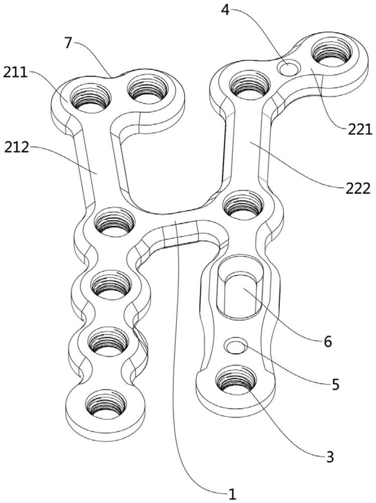 Wrist locking plate and osteosynthesis device