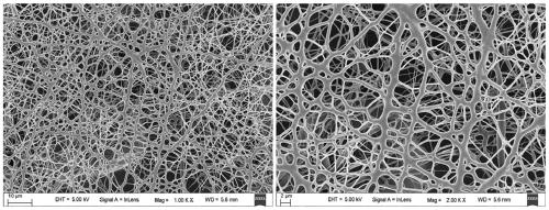 A chitosan-based multilayer nanofiber membrane dressing and its preparation method and application