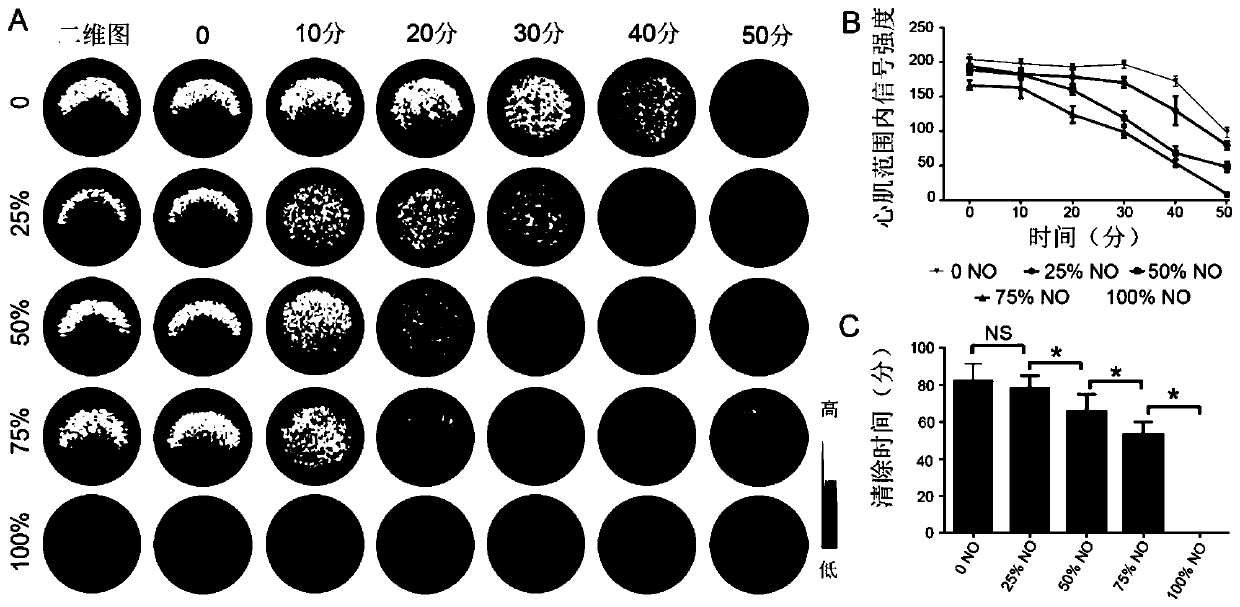 NO-loaded targeted microbubble, preparation method and application thereof