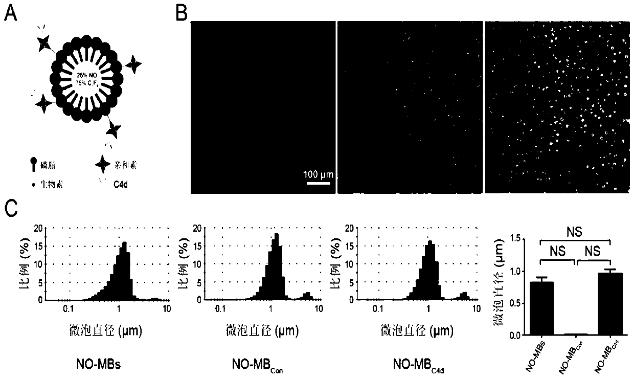 NO-loaded targeted microbubble, preparation method and application thereof