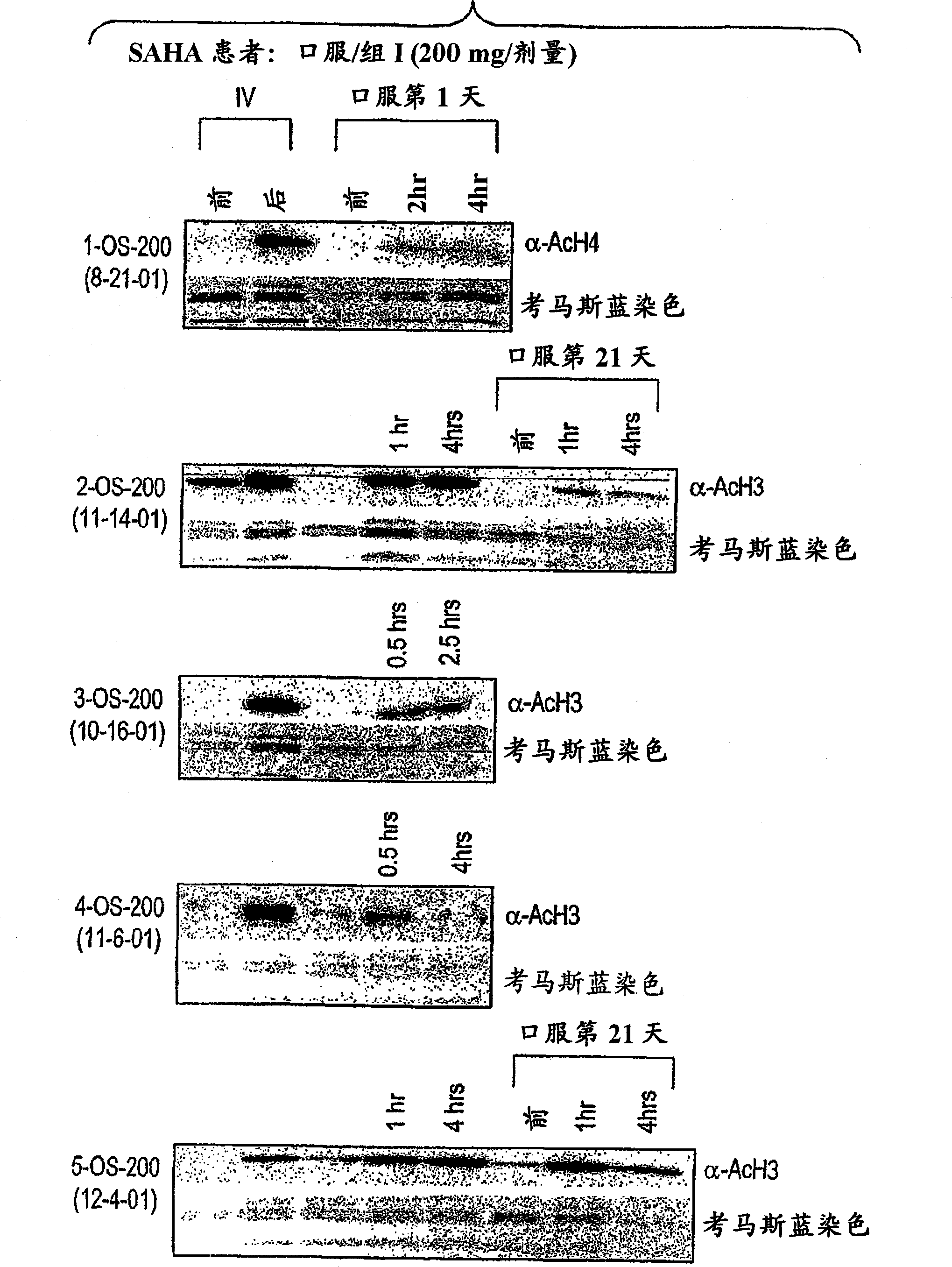 Methods of treating cancer with hdac inhibitors